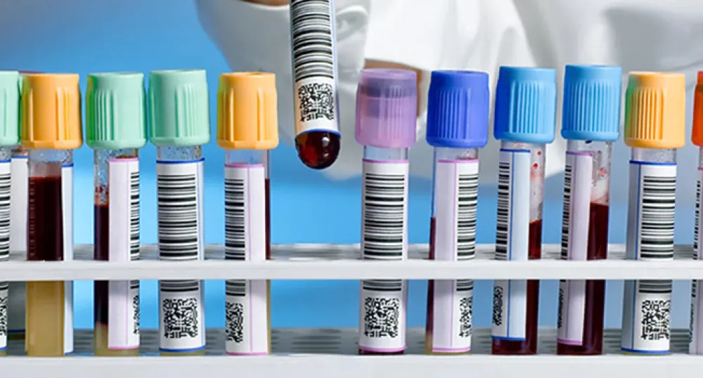 Blood samples in test tubes