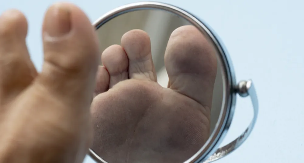 Foot Care PEI - Person looking at the sole of their foot in a mirror