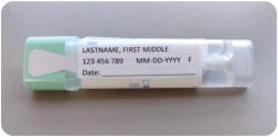 Fecal immunochemical test (FIT)